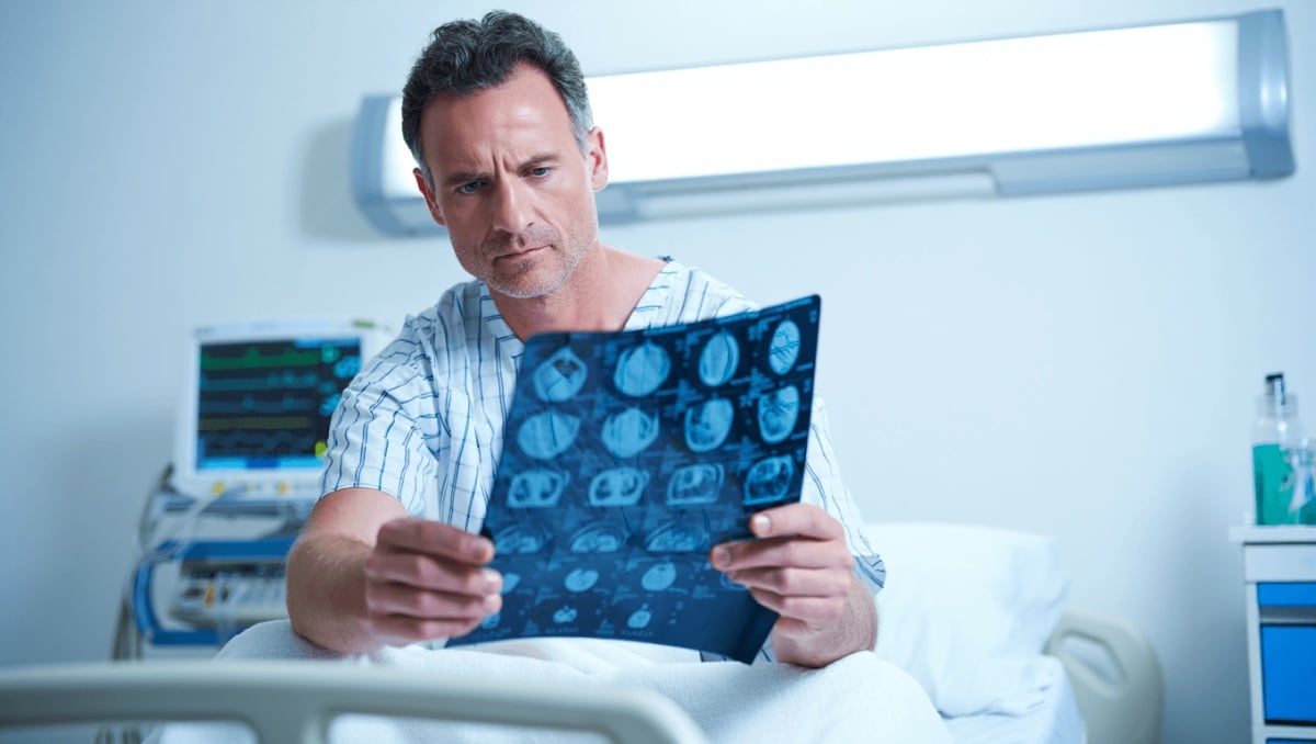 Prostate Cancer: After Years of Decline, Cases Rose Steadily Over Past Decade