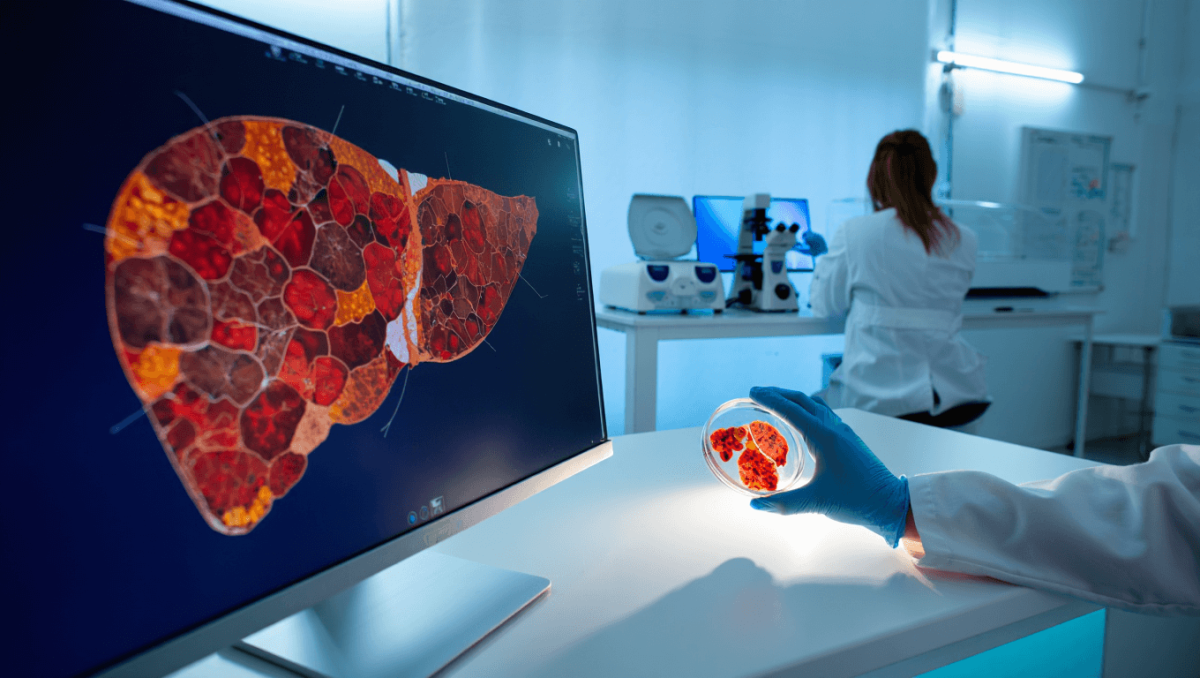 
		This type of diet may be physically changing your liver â€” and may lead to higher cancer risk	