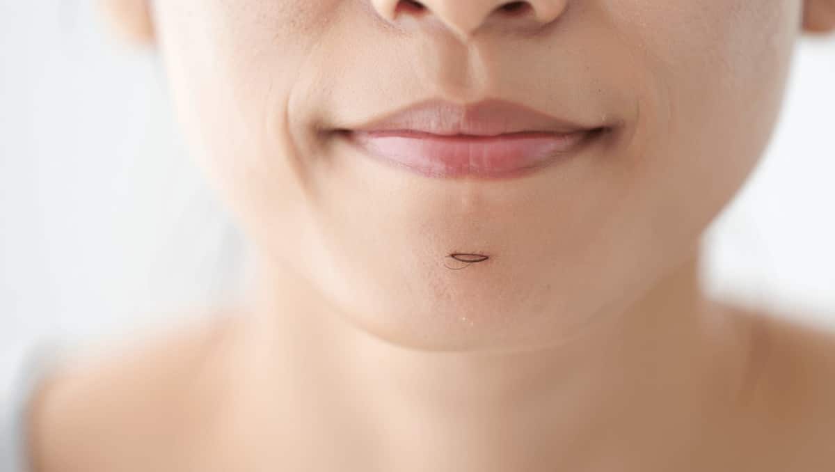 Les poils au menton chez la femme sont le signe de ...