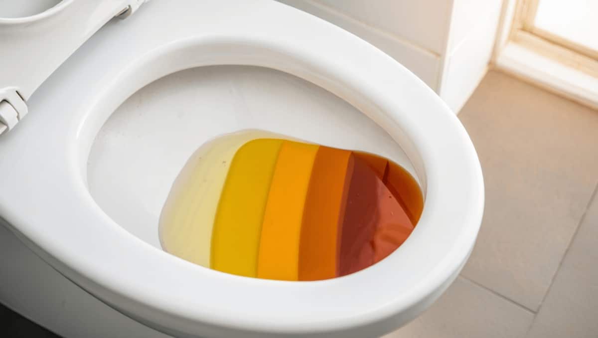 Les différentes couleurs d