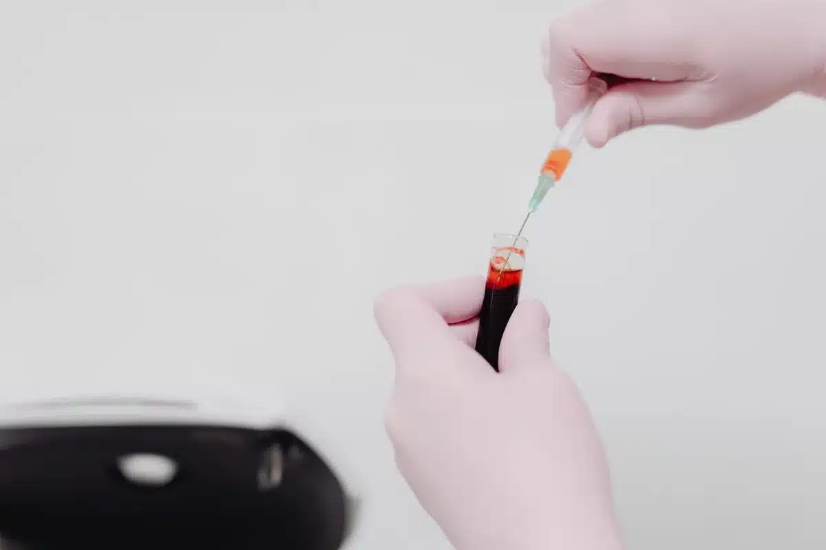 A healthcare professional drawing blood for laboratory testing to measure muscle damage markers.